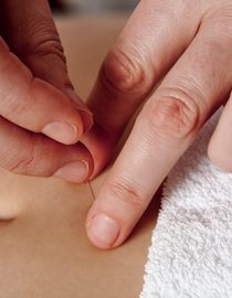 Acupuncture for OAB Acupuncture for OAB