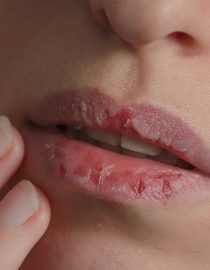 Coping With Dry Mouth Caused by Overactive Bladder Medication Coping With Dry Mouth Caused by Overactive Bladder Medication
